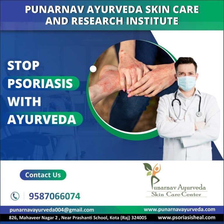 best-psoriasis-treatments-punarnavayurved.com2_-768x768