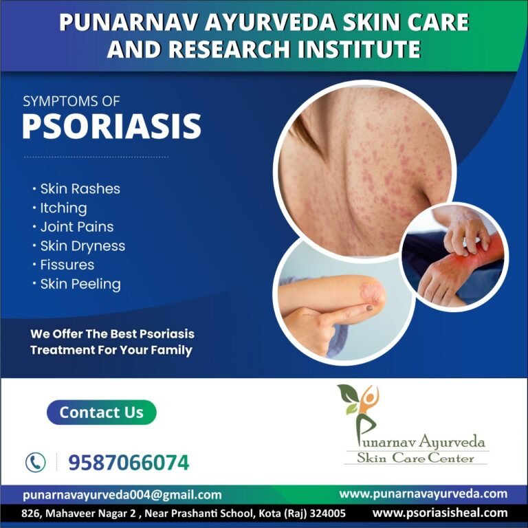 psoriasis-symptoms-punarnavayurved.com_-768x768