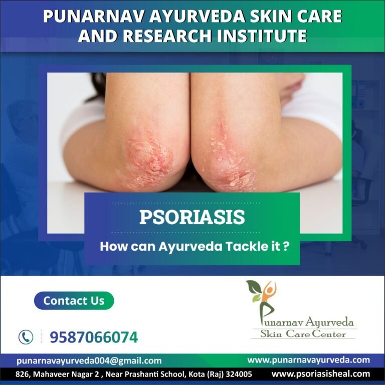 psoriasis-treatments-punarnavayurved.com5_-768x768